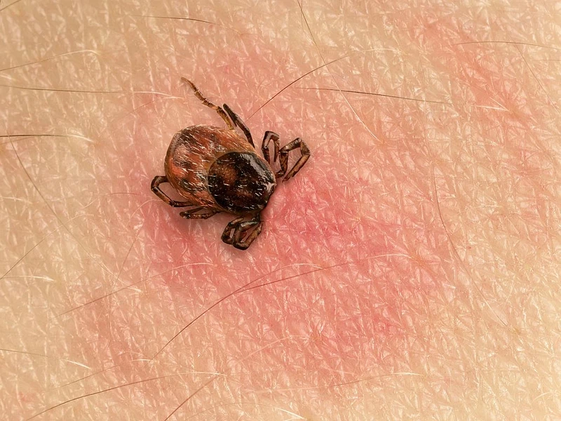 Naturalne sposoby walki z kleszczami
