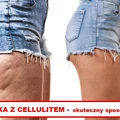Walczysz z CELLULITEM? Ta mikstura Ci w tym pomoże!
