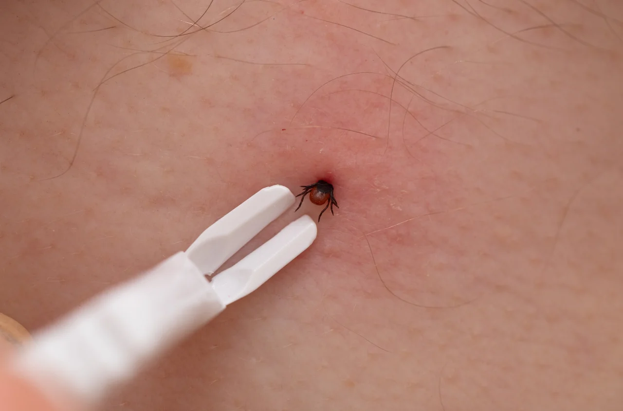 Dlaczego jednych kleszcze omijają, a innych nie? Wyniki badań dają do myślenia