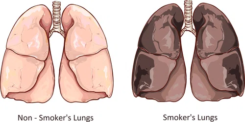 4 witaminy, które regenerują płuca palacza