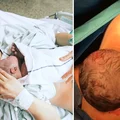 NOWY SPOSÓB RODZENIA - “Naturalne cesarskie cięcie”! Na czym polega?