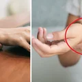Masz takie znamię na ręce? Nie jesteś jedyna! Już wiadomo, co ono oznacza
