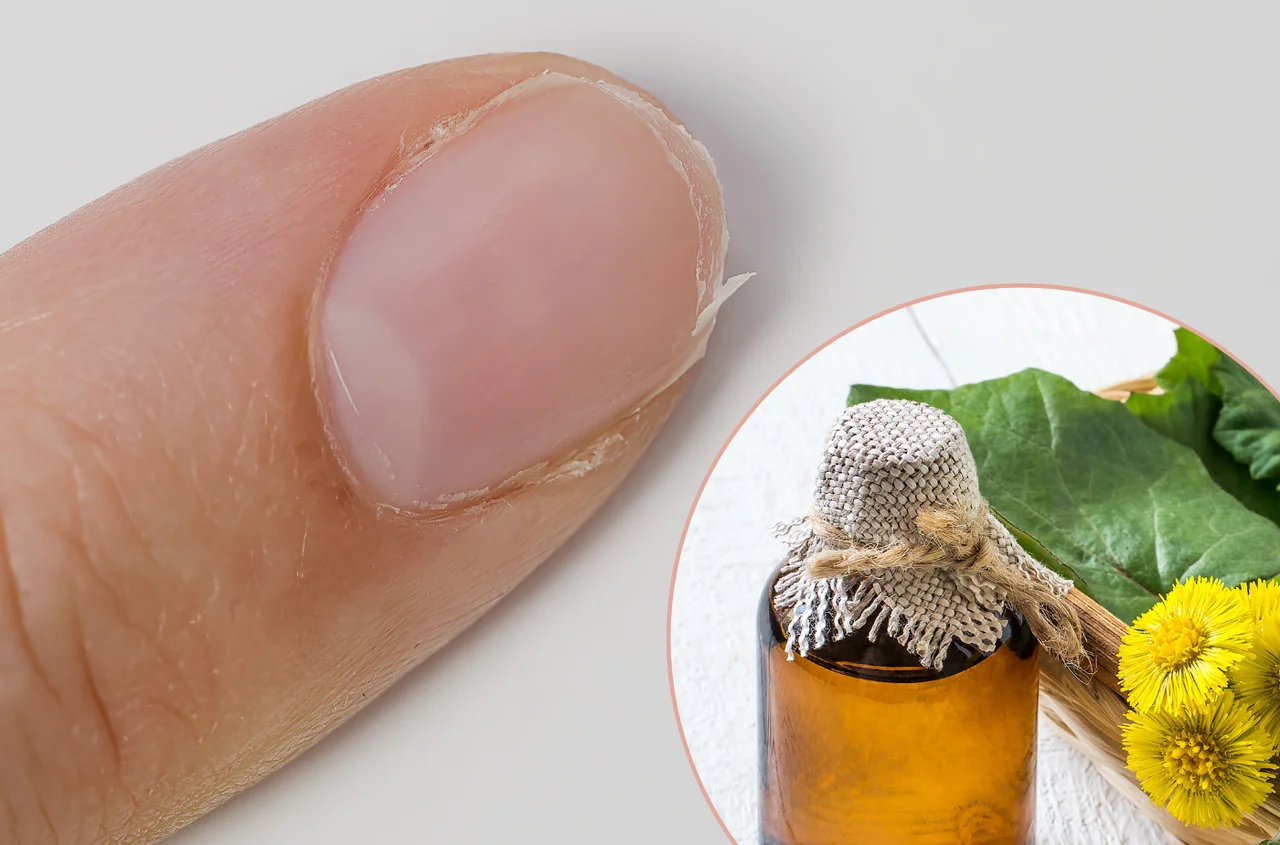 Ten syrop na kaszel działa też na… łamliwe paznokcie! Sprawdź, jak go stosować!