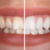 Biały uśmiech bez wizyty u dentysty? Odkryj sekretny składnik z Twojej kuchni!