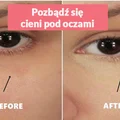 Jeden składnik, dzięki któremu pozbędziesz się cieni pod oczami