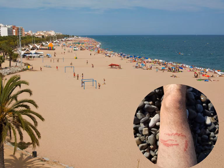 Zagrożenie dla plażowiczów w Hiszpanii! Szpitale odnotowują coraz więcej takich przypadków!