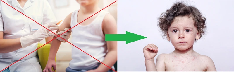 Jakie choroby nam grożą, jak nie będziemy się szczepić?