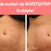 Jak pozbyć się ROZSTĘPÓW?