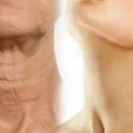 Skóra szyi starzeje się szybciej niż skóra twarzy! Zobacz jak zadbać o jej jędrność