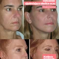 Face Fitness – ćwiczenie ujędrniające okolice oczu. [video]