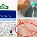 Mąka ziemniaczana - poznaj jej niezwykłe ZASTOSOWANIA!