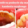 Prosty sposób na pozbycie się osadu i kamienia nazębnego.