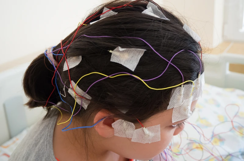 Międzynarodowy Dzień Epilepsji: Zwiększanie Świadomości i Wsparcie dla Osób Dotkniętych