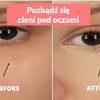 Jeden składnik, dzięki któremu pozbędziesz się cieni pod oczami