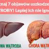 Poznaj 7 objawów uszkodzenia WĄTROBY! Lepiej ich nie ignoruj!