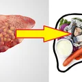 10 najlepszych produktów na detoks wątroby! Włącz je do codziennej diety