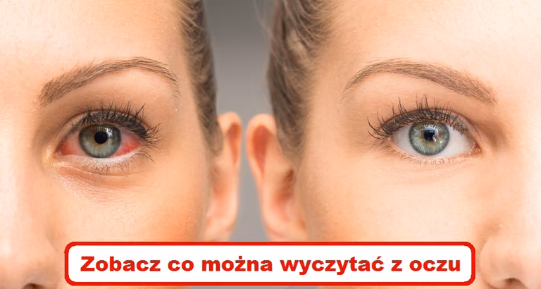 Co Twoje OCZY mogą powiedzieć o zdrowiu Twojego organizmu?