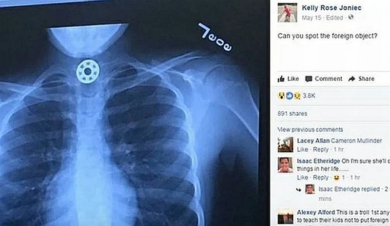 Pilnuj dziecka! Fidget spinner to niebezpieczna zabawka i narzędzie szatana!