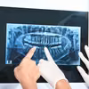 Potężne kolejki do dentysty na NFZ! Odkryj, gdzie czeka się wiecznie, a gdzie w mgnieniu oka!