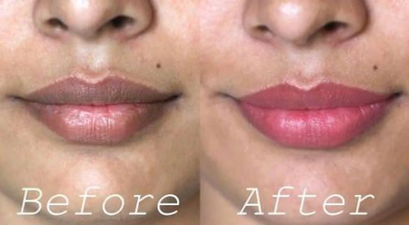 Domowy peeling, który przywraca ustom ich naturalne piękno