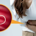 5 objawów obecności pasożytów w jelitach – nie ignoruj ich