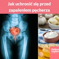 Jak uchronić się przed zapaleniem pęcherza