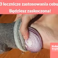 3 lecznicze zastosowania cebuli. Będziesz zaskoczona!