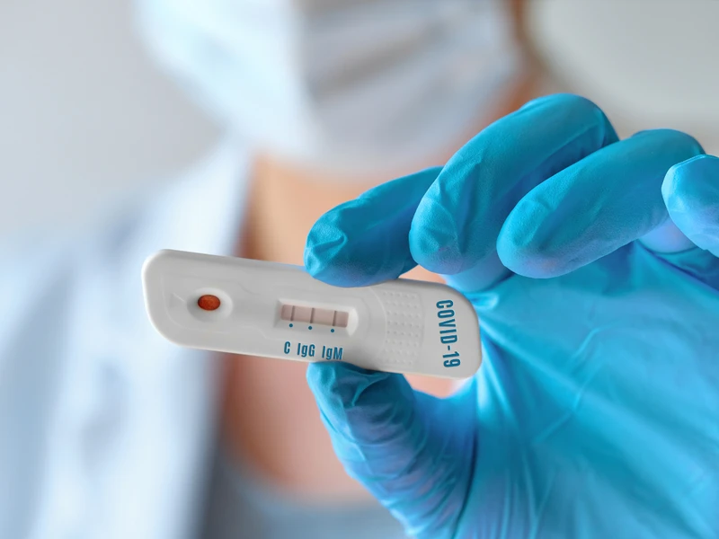 Szybki i tani test na koronawirusa? Przełomowy wynalazek polskich naukowców!