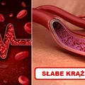 Poznaj sygnały ostrzegawcze które mogą świadczyć o ZŁYM KRĄŻENIU