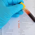 Masz takie objawy wiosną? Sprawdź poziom tych 5 hormonów!