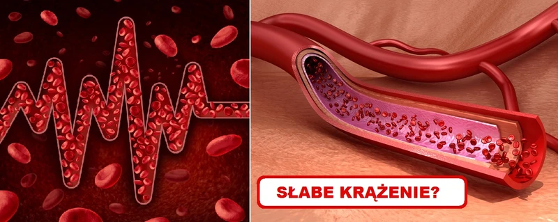 Poznaj sygnały ostrzegawcze które mogą świadczyć o ZŁYM KRĄŻENIU