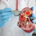Światowy Dzień Raka Nerki: Zwiększmy świadomość na temat tego groźnego schorzenia