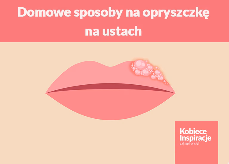 Domowe sposoby na opryszczkę na ustach - 5 SPRAWDZONYCH METOD