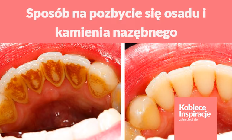 Prosty sposób na pozbycie się osadu i kamienia nazębnego.
