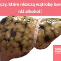 5 rzeczy, które niszczą wątrobę bardziej niż alkohol!