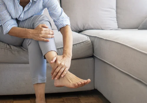 Zapobieganie opuchnięciu kostek nóg – praktyczne porady