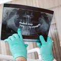 Usługi dentystyczne na NFZ! Więcej darmowych zabiegów już w tym roku! (LISTA)