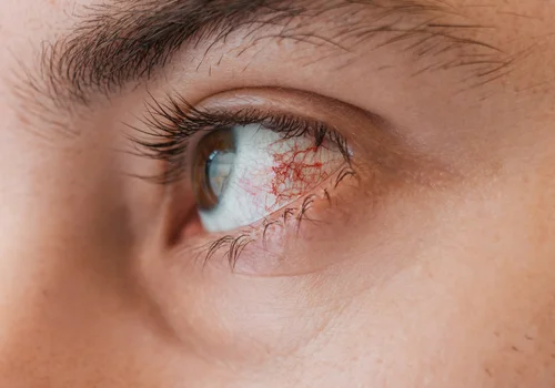 7 faktów o zdrowiu oczu, które każda kobieta powinna znać. Nr 3 może odmienić Twój wzrok