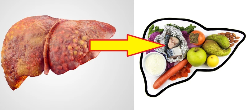 10 najlepszych produktów na detoks wątroby! Włącz je do codziennej diety