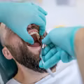 Absurdalne ceny u dentystów! Dlaczego jest tak drogo?