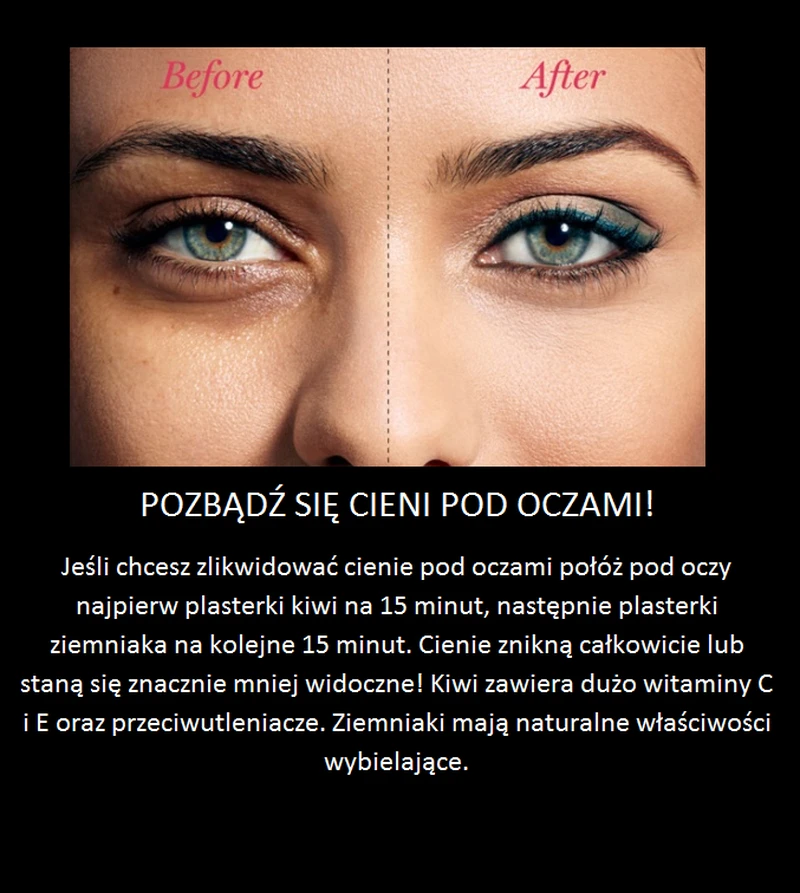Pozbądź się cieni pod oczami!
