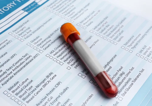 Darmowe badania krwi, cholesterolu i glukozy – program Profilaktyka 40 Plus kończy się już w grudniu!