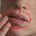 Co Twoje usta mówią o Twoim zdrowiu?