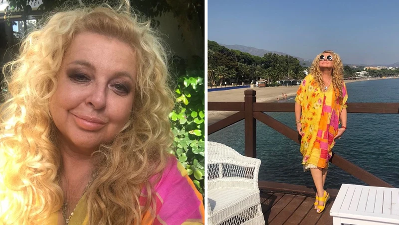 Magda Gessler ujawnia, co się stało z jej twarzą i ostro odpowiada na krytykę