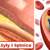 Ta receptura oczyści Twoje TĘTNICE i ochroni Cię przed zawałem!