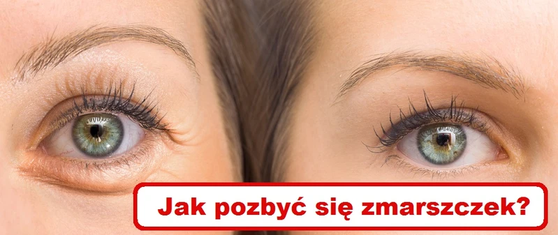 Poznaj naturalne sposoby na ZMARSZCZKI