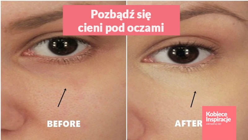 Jeden składnik, dzięki któremu pozbędziesz się cieni pod oczami