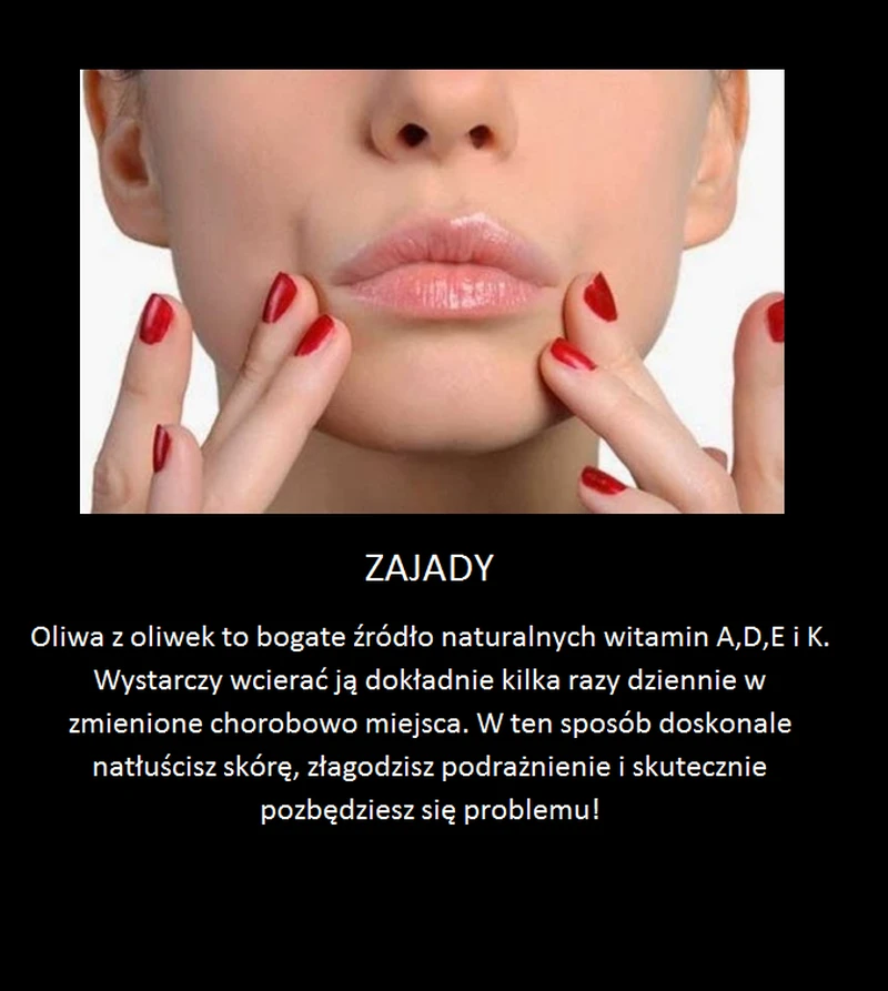 Domowy sposób za zajady
