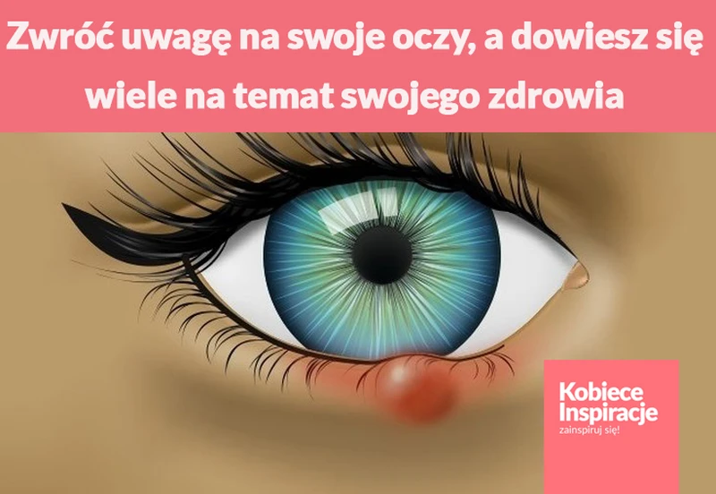 Zwróć uwagę na swoje oczy, a dowiesz się wiele na temat swojego zdrowia