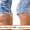 Walczysz z CELLULITEM? Ta mikstura Ci w tym pomoże!